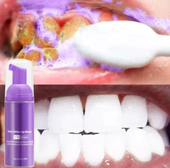 Smoke Stain Removal Teeth Mousse